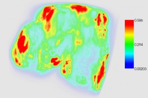 Thermal of a human tibia.